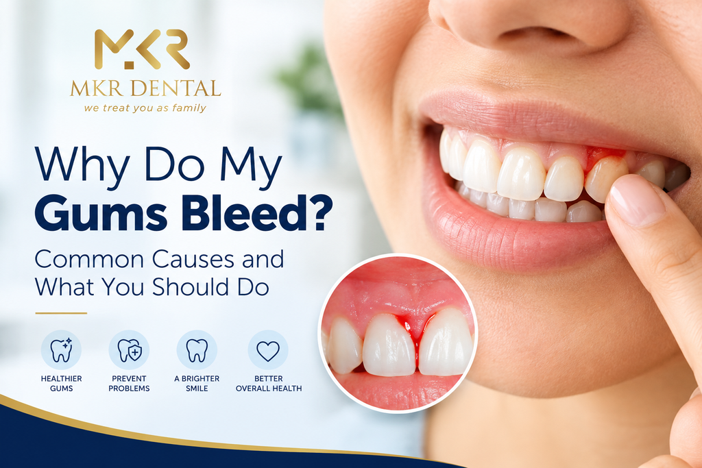 Bleeding gums
